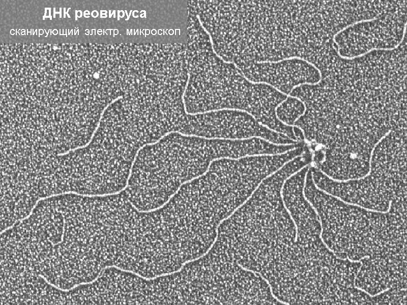 ДНК реовируса сканирующий электр. микроскоп